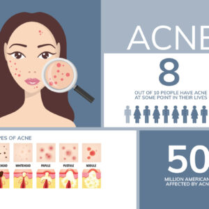 Acne Awareness