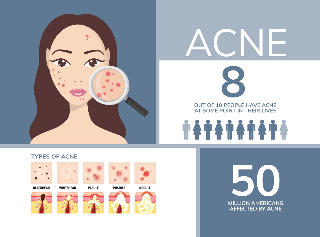 Acne Awareness - DermPhysicians of New England