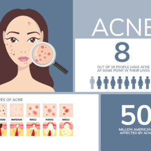 Acne Across The Ages